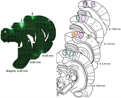 Topographic Organization of Cholinergic Innervation From the Basal Forebrain to the Visual Cortex in the Rat